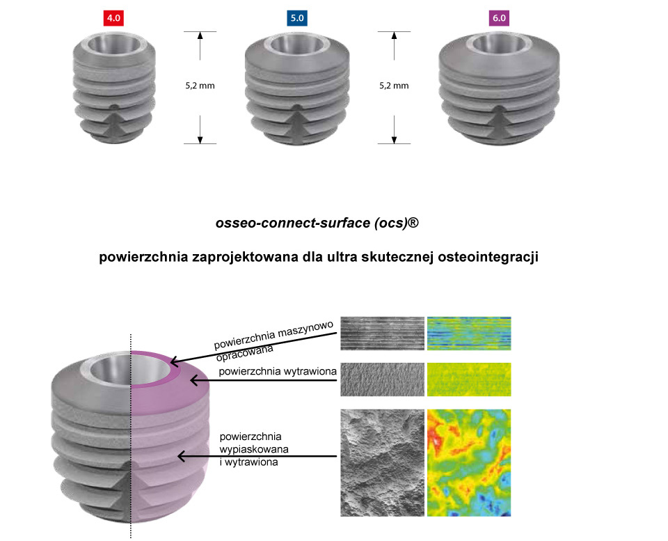 Pobierz grafikę, aby zobaczyć treść